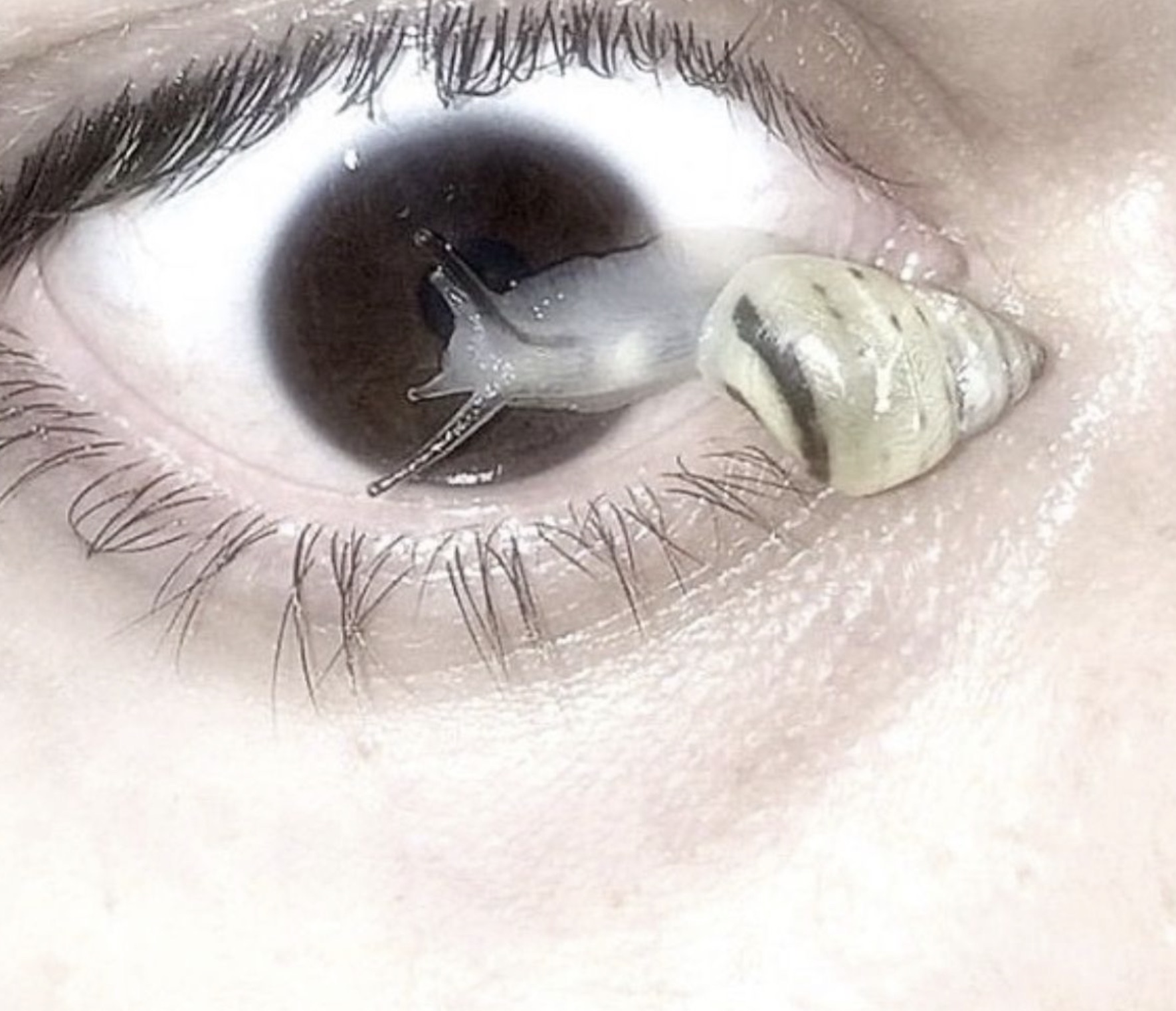 weird things in eye